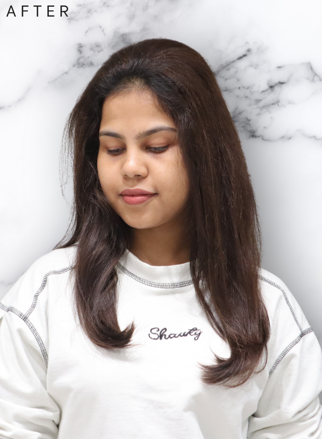 Topper Lace base -3" * 5" scalp topper