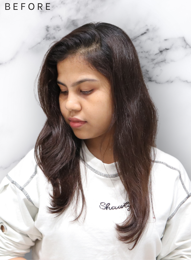 Topper Lace base -3" * 5" scalp topper